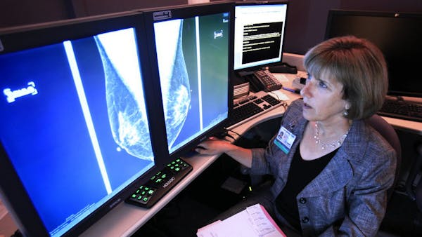 StribCast: A major breast cancer discovery at U